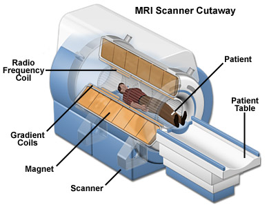 mri-scanner